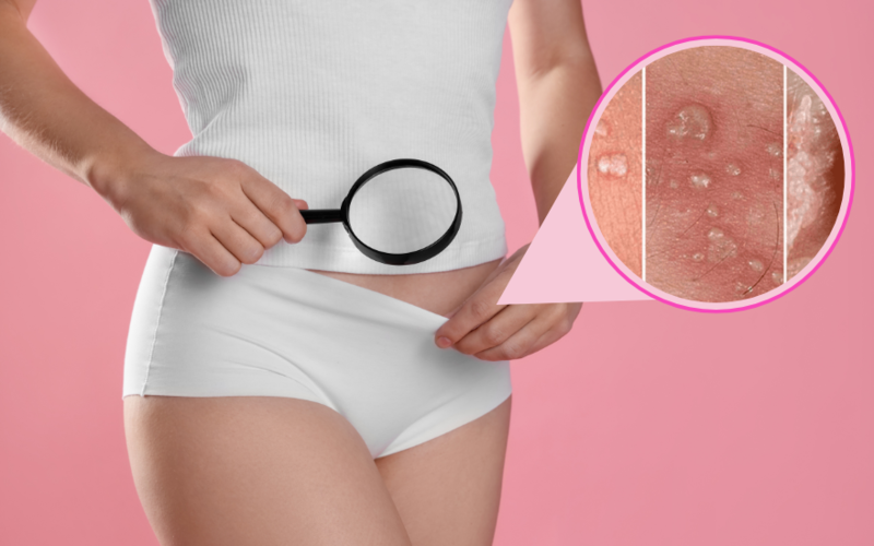 Nếu vùng da sưng đỏ, đau kéo dài hoặc có mụn mủ, nên đi khám để được tư vấn